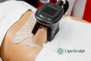 Does Fat Freezing At Home Work? 3 Fat freezing at home from Lipo Sculpt Faringdon